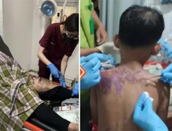 Ibu dan Anak di Sukabumi Disiram Air Keras saat Naik Motor