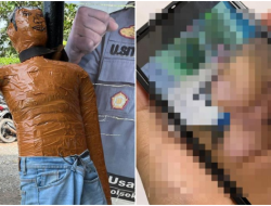 Dua Polisi Hajar Tahanan hingga Tewas, Mayat Korban Digantung Seolah Bunuh Diri, Bukti CCTV Rusak