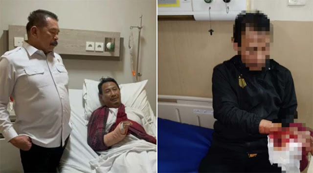 Staf Kejagung Diserang Sajam oleh OTK di Depok, Alami Luka Berat