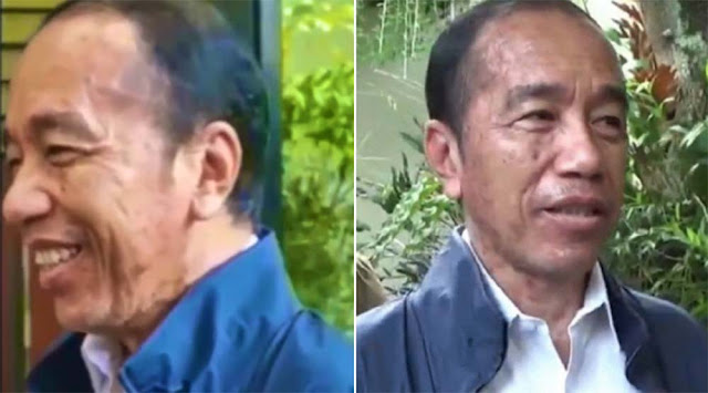 Sedang Proses Penyembuhan, Jokowi Kena Alergi Kulit
