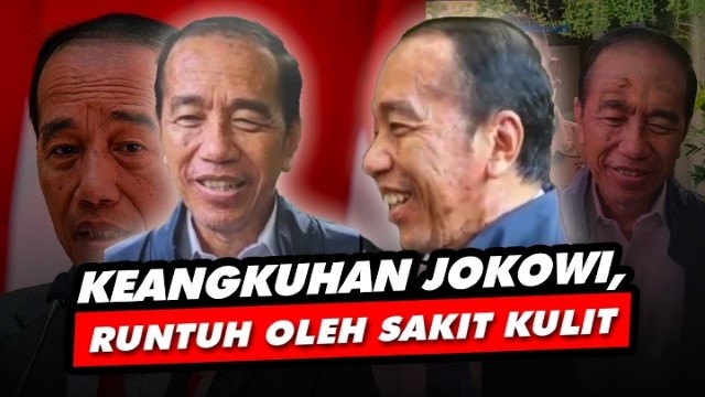 Jokowi Klaim Penyakit Kulit Dari Vatikan, Buni Yani Ungkap Kejanggalan Ini!