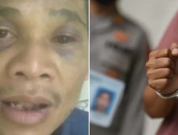 Pemuda Jadi Korban Salah Tangkap Anggota Polres Cianjur. Kondisi Badan Penuh Luka dan Babak Belur