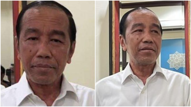 Kondisi Terkini Jokowi Seusai Disebut Sakit Autoimun, Wajah Bercak Putih dan Warna Kulit Beda Drastis
