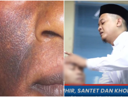 Jin Pendamping Disebut-sebut Bikin Wajah Manusia jadi Menghitam, Ini Penjelasan Pakar Ruqyah