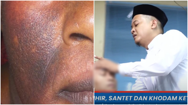 Jin Pendamping Disebut-sebut Bikin Wajah Manusia jadi Menghitam, Ini Penjelasan Pakar Ruqyah