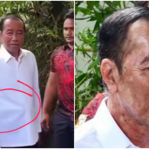 Jokowi Rayakan Ulang Tahun Ke-64, Kondisi Wajahnya Jadi Sorotan
