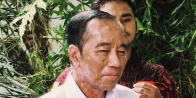 Jokowi Sakit Kulit, Roy Suryo Bandingkan dengan Mustafa Kemal Ataturk