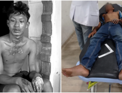 Tragis! Remaja Dibakar Hidup-hidup Usai Curi Ubi, Oknum Brimob dan ASN Jadi Tersangka