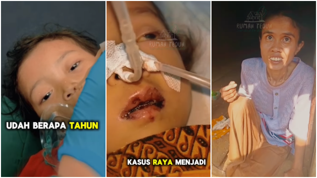 Ibu Gangguan Jiwa dan Ayah TBC, Bocah 4 Tahun Meninggal Tubuhnya Penuh Cacing, Bertelur Sampai Otak