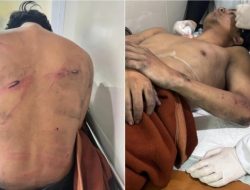 BRUTAL! Pria Ini Jadi Korban Salah Sasaran Polisi Saat Demo Bandung: Niat Cuman Lewat, Malah Digebuk