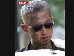 Siapa Faisal Icang? Korban Congkel Mata yang Viral Meninggal Dunia