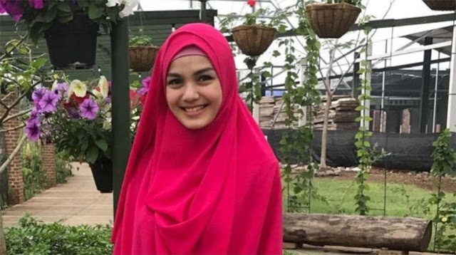 Nadya Almira Bereaksi Usai Kasus Tabrak Larinya Diungkit, Singgung Surat Perjanjian dengan Keluarga