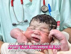 Ibu Pakai KB IUD, Bayinya Lahir Pegang Alat Kontrasepsi Ibunya yang Viral!