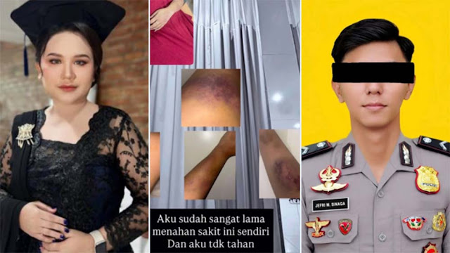 Oknum Brimob di Sumut Diduga Aniaya Mantan Pacar, Korban Alami Memar dan Bengkak