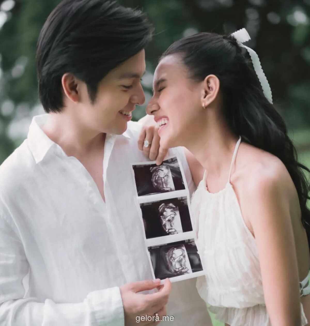 Angga Yunanda dan Shenina Cinnamon Umumkan Kehamilan Anak Pertama di Hari Jadi Pernikahan